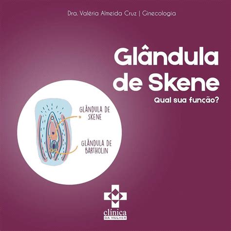 glândulas de bartholin e de skene|Glândula de Skene: Como tratar a Inflamação, cisto e abscesso